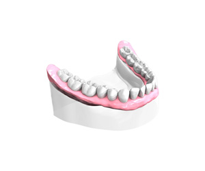 Remplacer toutes les dents absentes ou abîmées - Dentiste Vannes