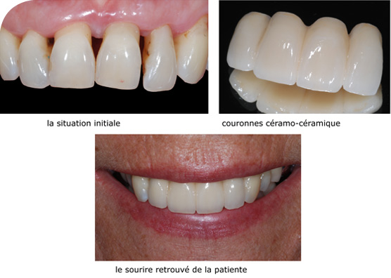 éhabilitation du sourire - Dentiste Vannes
