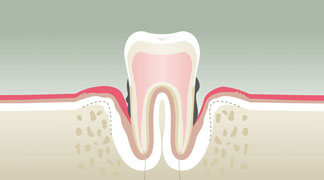 Parodontologie & Hygiène à Vannes