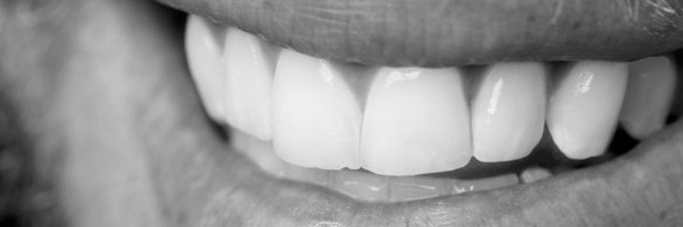 Conseils et précautions - Dentiste Vannes